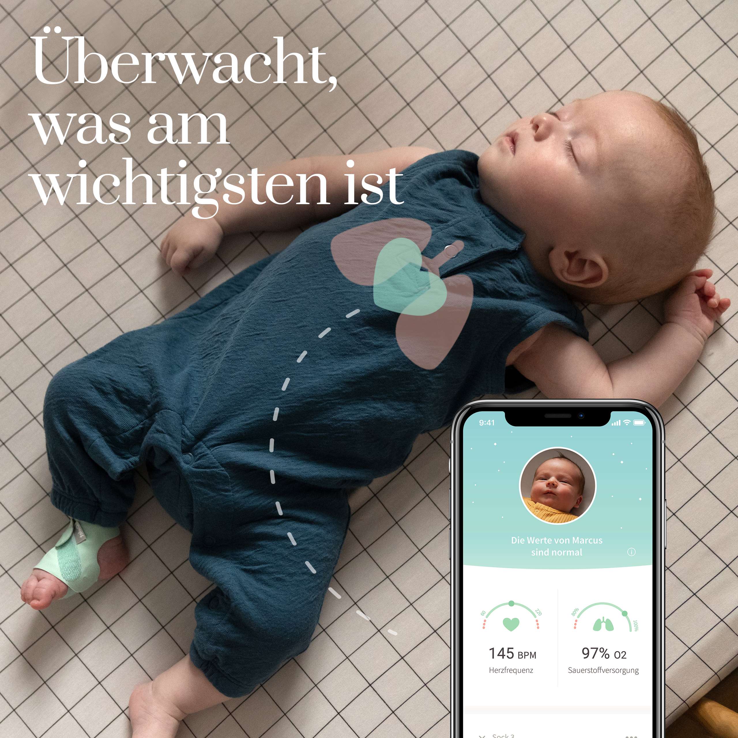 850017640122_18680_SmartSock_36G7Gk6PYkOAv3u